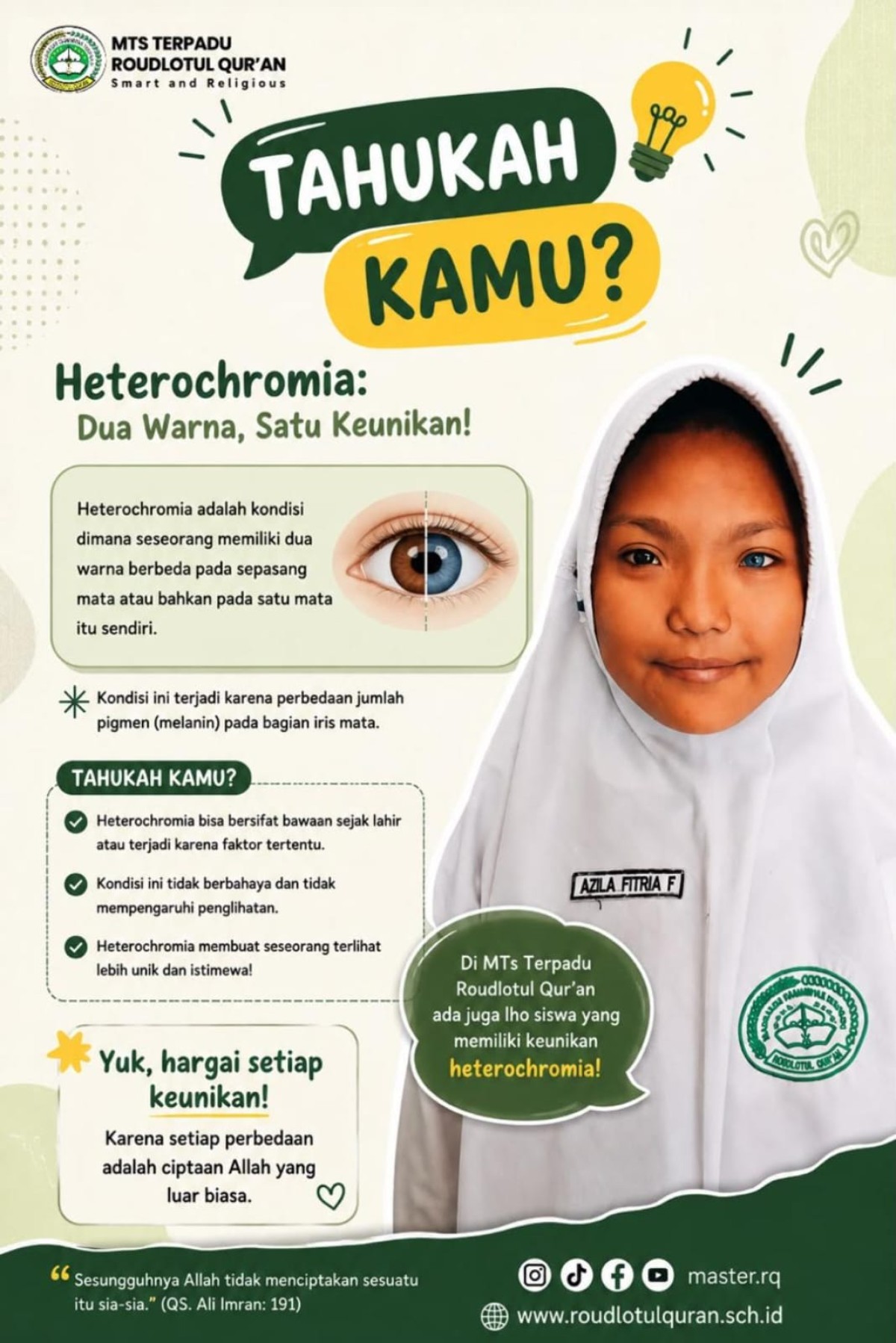 Heterochromia